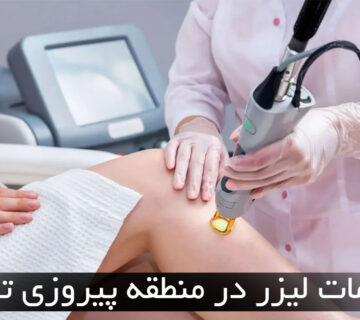 لیزر در پیروزی